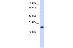 WB Suggested Anti-PHF19 Antibody Titration:  0. (PHF19 Antikörper  (C-Term))