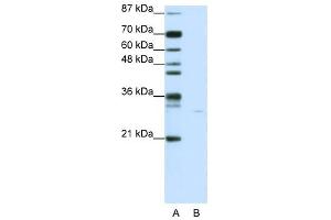 SGK1 antibody used at 1 ug/ml to detect target protein. (SGK1 Antikörper  (N-Term))