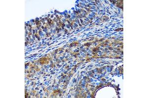 Immunohistochemistry of paraffin-embedded Rat ovary using TSN Rabbit pAb  at dilution of 1:100 (40x lens). (Translin Antikörper  (AA 50-150))
