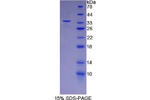 SDS-PAGE analysis of Rat FSTL1 Protein. (FSTL1 Protein)