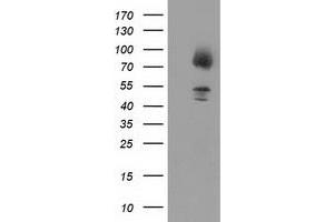 Western Blotting (WB) image for anti-Gephyrin (GPHN) antibody (ABIN1498426)