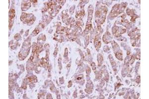 Image no. 2 for anti-Calpastatin (CAST) (AA 275-700) antibody (ABIN1497106) (Calpastatin Antikörper  (AA 275-700))