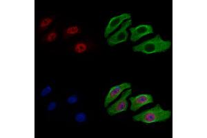 ABIN7093308 and ABIN7097327 staining Hela cells by IF/ICC. (CHEK2 Antikörper  (C-Term))