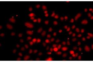 Immunofluorescence analysis of A549 cells using RRAGC Polyclonal Antibody
