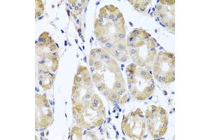 Immunohistochemistry of paraffin-embedded human stomach using CBR4 antibody (ABIN5972931) at dilution of 1/100 (40x lens). (CBR4 Antikörper)