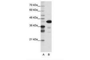 Image no. 1 for anti-TAR DNA Binding Protein (TARDBP) (N-Term) antibody (ABIN202468) (TARDBP Antikörper  (N-Term))