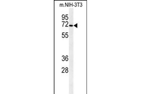 CSGALNACT1 Antikörper  (AA 192-220)