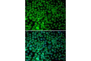 Immunofluorescence analysis of MCF-7 cells using RBX1 antibody.