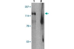 Western blot analysis of SGSM2 in human cerebellum tissue with SGSM2 polyclonal antibody  at 1 ug/mL in (1) the absence and (2) the presence of blocking peptide. (SGSM2 Antikörper  (Internal Region))