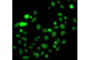 Immunofluorescence analysis of U2OS cells using PMS2 Polyclonal Antibody (PMS2 Antikörper)