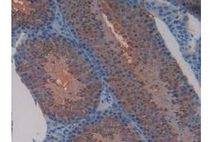 IHC-P analysis of Mouse Testis Tissue, with DAB staining. (TFAM Antikörper  (AA 43-243))