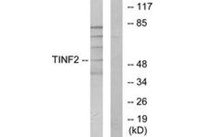 Western blot analysis of extracts from HuvEc cells, using TINF2 Antibody. (TINF2 Antikörper  (AA 71-120))