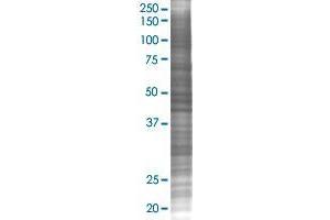 NXNL1 293T Cell Transient Overexpression Lysate(Denatured)