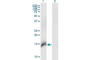 Western Blot analysis of CBY1 expression in transfected 293T cell line by CBY1 monoclonal antibody (M06), clone 2F2. (CBY1/PGEA1 Antikörper  (AA 18-126))