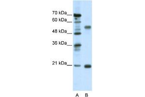 Western Blotting (WB) image for anti-Cholinergic Receptor, Nicotinic, beta 3 (Neuronal) (CHRNB3) (Middle Region) antibody (ABIN2792254)