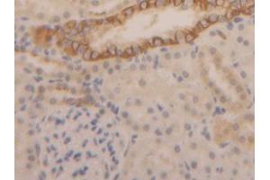 DAB staining on IHC-P; Samples: Rat Kidney Tissue (Cytokeratin 1 Antikörper  (AA 350-488))