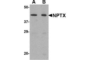 Western Blotting (WB) image for anti-Neuronal Pentraxin II (NPTX2) (Middle Region) antibody (ABIN1031027) (NPTX2 Antikörper  (Middle Region))