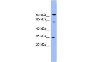 WB Suggested Anti-CPNE6 Antibody Titration: 0. (CPNE6 Antikörper  (Middle Region))