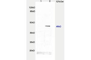 L1 rat brain, L2 human colon carcinoma lysates probed  at 1:200 in 4˚C. (TWIST1, TWIST2 (AA 71-170) Antikörper)