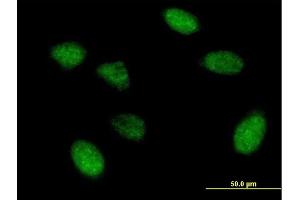 Immunofluorescence of purified MaxPab antibody to EIF5A2 on HeLa cell. (EIF5A2 Antikörper  (AA 1-153))
