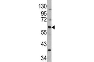 Western blot analysis of MDM2 antibody and 293 lysate (MDM2 Antikörper  (AA 141-176))