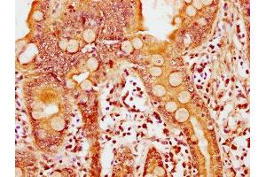 IHC image of ABIN7149505 diluted at 1:600 and staining in paraffin-embedded human small intestine tissue performed on a Leica BondTM system.
