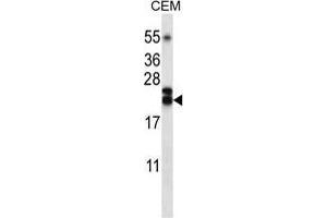 TNFSF4 Antibody (Center) western blot analysis in CEM cell line lysates (35 µg/lane). (TNFSF4 Antikörper  (Middle Region))