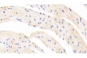 Detection of EPOR in Mouse Cardiac Muscle Tissue using Polyclonal Antibody to Erythropoietin Receptor (EPOR) (EPOR Antikörper  (AA 45-244))