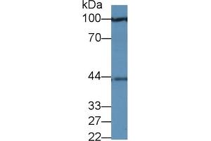 Detection of PRAME in Human 293T cell lysate using Polyclonal Antibody to Preferentially Expressed Antigen In Melanoma (PRAME) (PRAME Antikörper  (AA 416-502))