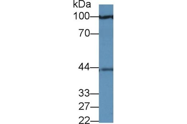 PRAME antibody  (AA 416-502)