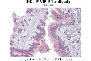 Image no. 1 for anti-Vasoactive Intestinal Peptide Receptor 1 (VIPR1) antibody (ABIN375279)