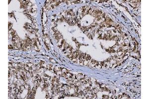 IHC analysis of TIP49A/RUVBL1 using anti-TIP49A/RUVBL1 antibody (ABIN7599928). (RUVBL1 Antikörper  (AA 13-23))