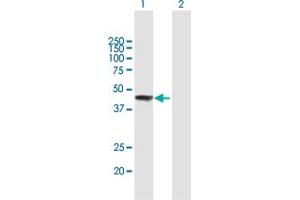 Western Blot analysis of ZCCHC11 expression in transfected 293T cell line by ZCCHC11 MaxPab polyclonal antibody.