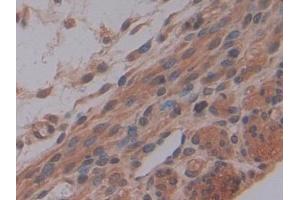 Immunohistochemistry (IHC) image for anti-Matrix Metallopeptidase 7 (Matrilysin, Uterine) (MMP7) (AA 1-264) antibody (ABIN7431017)