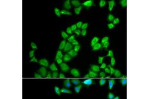 Immunofluorescence analysis of MCF-7 cells using RNASE13 Polyclonal Antibody (RNASE13 Antikörper)