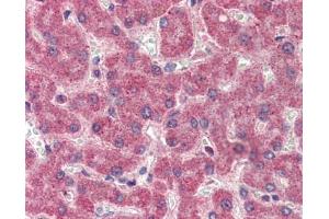 Factor II antibody was used for immunohistochemistry at a concentration of 4-8 ug/ml. (Factor II Antikörper)