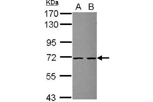 Western Blotting (WB) image for anti-Zinc Finger, SWIM-Type Containing 2 (ZSWIM2) (AA 350-575) antibody (ABIN1501868)