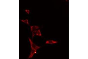 ABIN6275083 staining HeLa cells by IF/ICC. (DNAL1 Antikörper  (Internal Region))