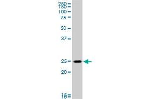 RAB33B monoclonal antibody (M01), clone 6F4. (RAB33B Antikörper  (AA 117-206))