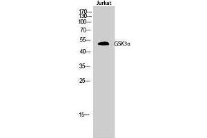 Western Blotting (WB) image for anti-Glycogen Synthase Kinase 3 alpha (GSK3a) (Ser45) antibody (ABIN3175439) (GSK3 alpha Antikörper  (Ser45))