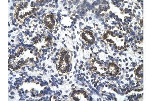 Rabbit Anti-TAF5L Antibody       Paraffin Embedded Tissue:  Human alveolar cell   Cellular Data:  Epithelial cells of renal tubule  Antibody Concentration:   4. (TAF5L Antikörper  (N-Term))