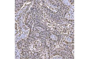 IHC analysis of SNRPA1 using anti-SNRPA1 antibody (ABIN7599131). (SNRPA1 Antikörper  (AA 1-233))