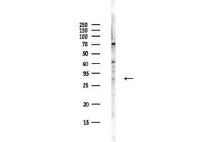 anti-Prostate Androgen-Regulated Mucin-Like Protein 1 (PARM1) antibody
