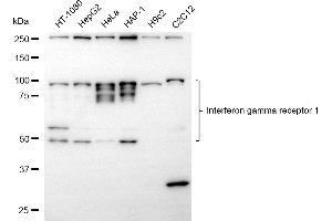 Western blotting analysis using interferon gamma receptor 1 antibody (ABIN7799082).