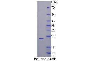 SDS-PAGE analysis of Mouse CDKN2B Protein. (CDKN2B Protein)