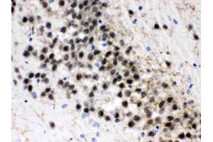 ZWINT was detected in paraffin-embedded sections of rat brain tissues using rabbit anti- ZWINT Antigen Affinity purified polyclonal antibody (Catalog # ) at 1 µg/mL. (ZWINT Antikörper  (AA 29-249))