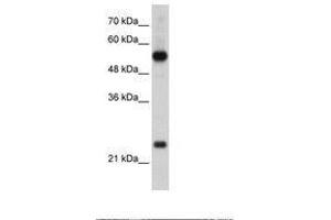 Image no. 1 for anti-Ribosomal Protein L13 (RPL13) (AA 136-185) antibody (ABIN203301) (RPL13 Antikörper  (AA 136-185))