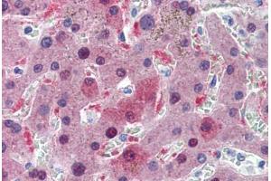 Human Liver: Formalin-Fixed, Paraffin-Embedded (FFPE) (GSTA1 Antikörper  (AA 1-222))