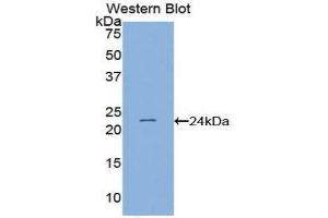 Western Blotting (WB) image for anti-PC4 and SFRS1 Interacting Protein 1 (PSIP1) (AA 311-469) antibody (ABIN1859640) (PSIP1 Antikörper  (AA 311-469))