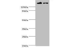 Western blot All lanes: SETDB1 antibody at 5 μg/mL Lane 1: Rat adrenal gland tissue Lane 2: 293T whole cell lysate Secondary Goat polyclonal to rabbit IgG at 1/10000 dilution Predicted band size: 144, 45 kDa Observed band size: 144 kDa (SETDB1 Antikörper  (AA 1-397))